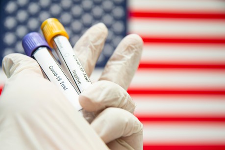 La barre des 1.000 décès a été franchie aux États-Unis. (Photo: Shutterstock)