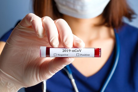 3 décès et 127 nouveaux cas ont été confirmés au cours des 24 dernières heures par la direction de la Santé du ministère de la Santé. (Photo: Shutterstock)