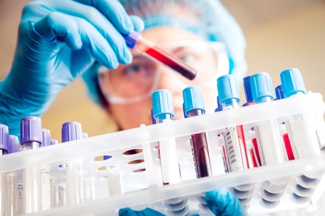 L’entreprise strasbourgeoise Biosynex aurait mis au point un nouveau test sérologique à partir d’une simple goutte de sang. (Photo: Shutterstock)