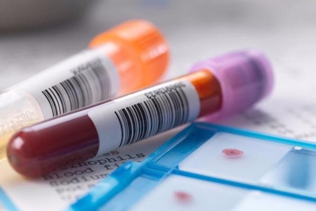 La mise en place de Picken Doheem sonne l’heure de la transformation du processus de prise de sang. (Photo: DR)