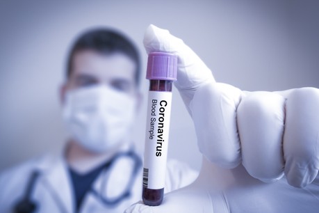 La pandémie de coronavirus a fait 33.000 victimes dans le monde depuis son début. (Photo: Shutterstock)
